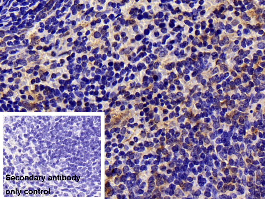 Polyclonal Antibody to Protein Kinase C Eta (PKCh)