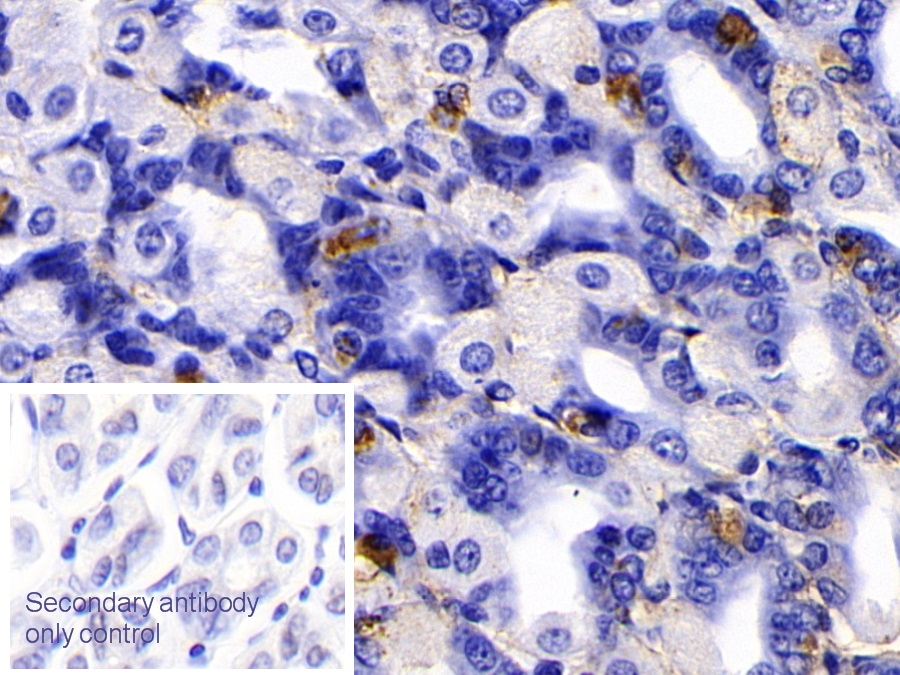 Polyclonal Antibody to Immunoglobulin G4 (IgG4)