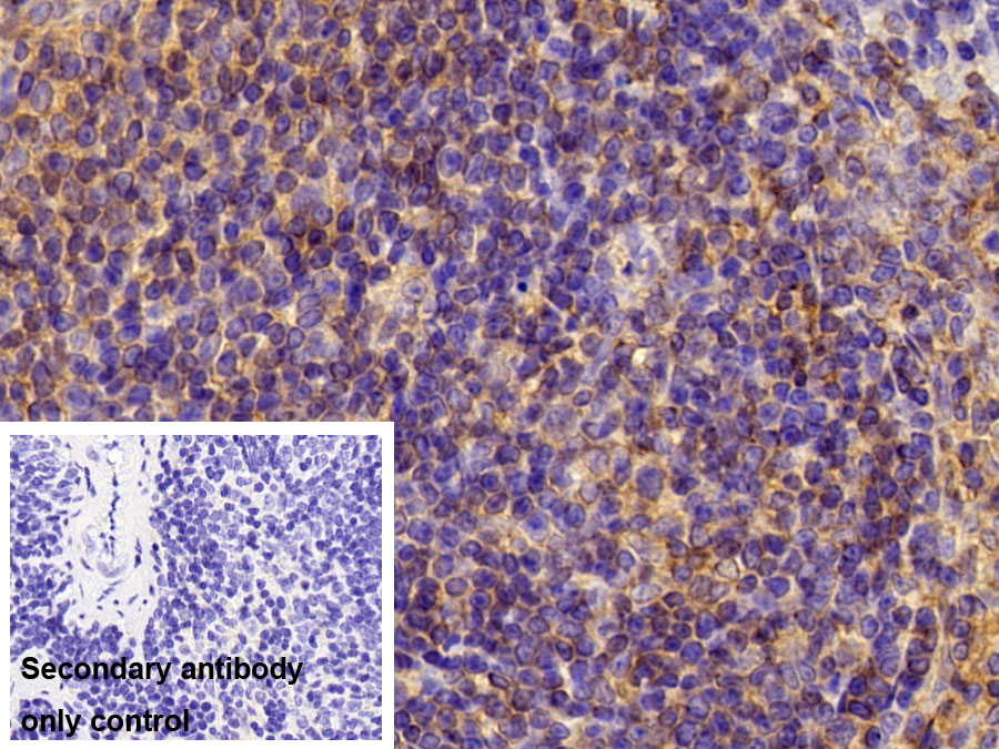 Polyclonal Antibody to Immunoglobulin G4 (IgG4)