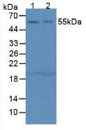 Polyclonal Antibody to Complement 1 Inhibitor (C1INH)