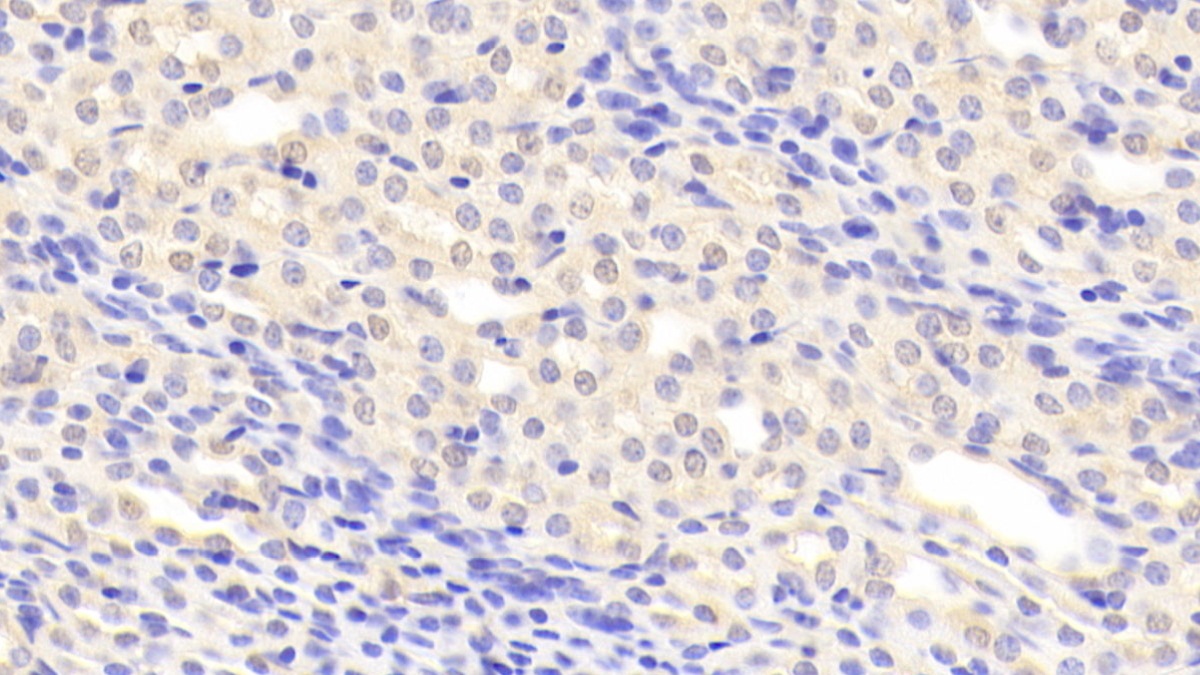 Polyclonal Antibody to Complement 1 Inhibitor (C1INH)