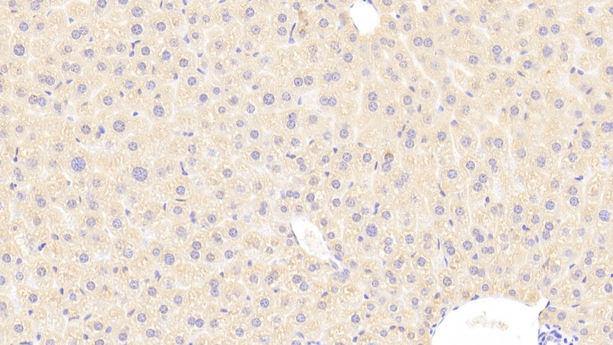 Polyclonal Antibody to Complement 1 Inhibitor (C1INH)