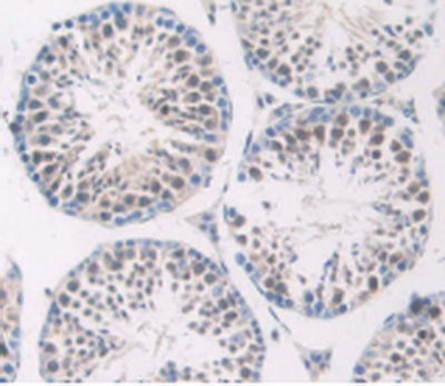 Polyclonal Antibody to Complement 1 Inhibitor (C1INH)