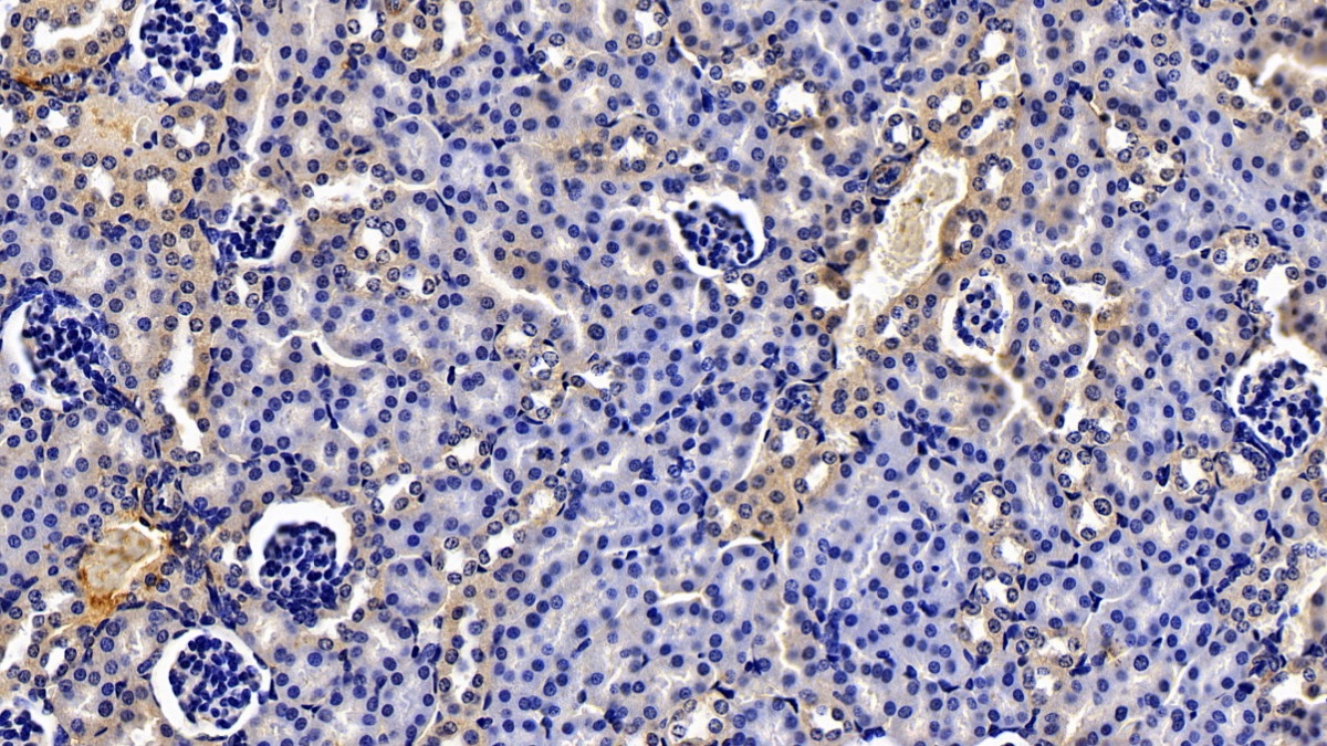 Polyclonal Antibody to Complement 1 Inhibitor (C1INH)