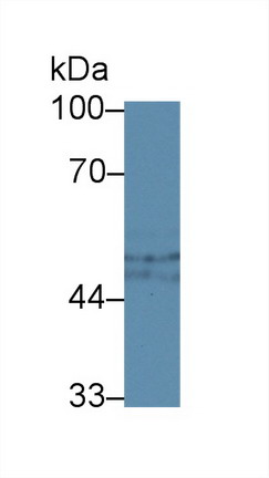 Polyclonal Antibody to Complement 1 Inhibitor (C1INH)