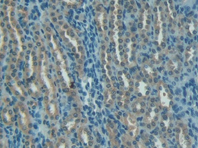 Polyclonal Antibody to Complement 1 Inhibitor (C1INH)