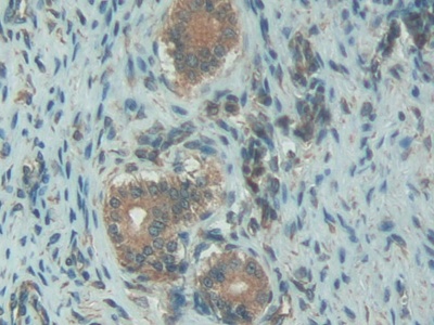 Polyclonal Antibody to Complement 1 Inhibitor (C1INH)