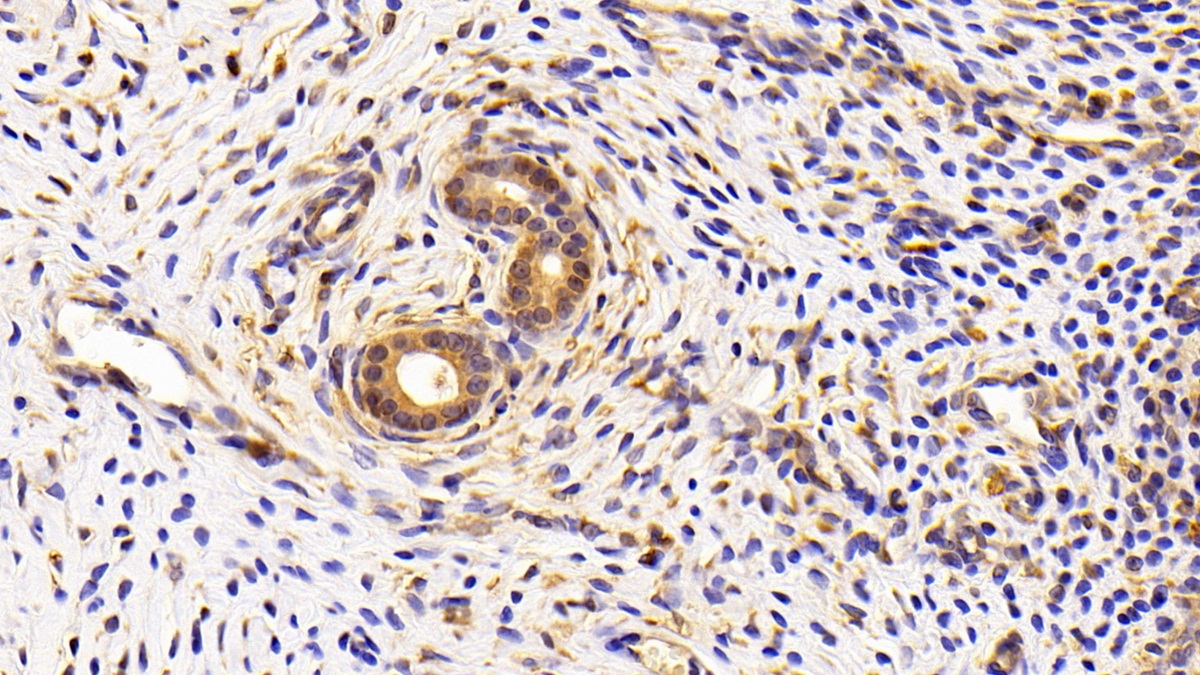 Polyclonal Antibody to Complement 1 Inhibitor (C1INH)