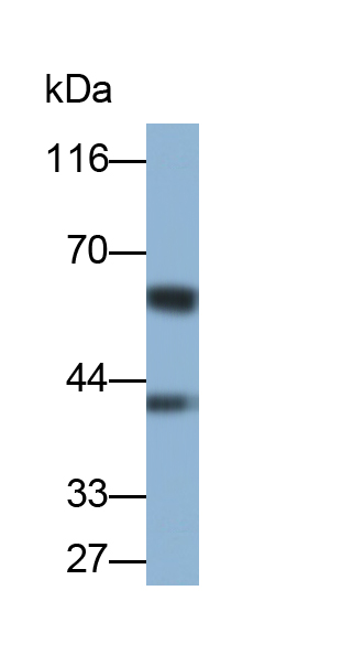 Polyclonal Antibody to Tyrosinase (TYR)