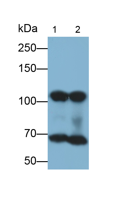 Polyclonal Antibody to Tyrosinase (TYR)