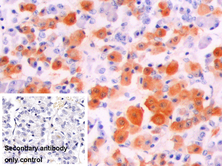 Polyclonal Antibody to Alpha-Melanocyte Stimulating Hormone (aMSH)