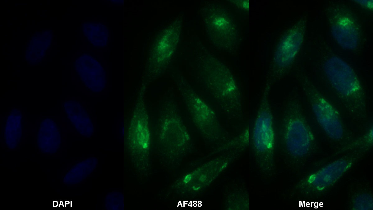 Polyclonal Antibody to Nesfatin 1 (NES1)