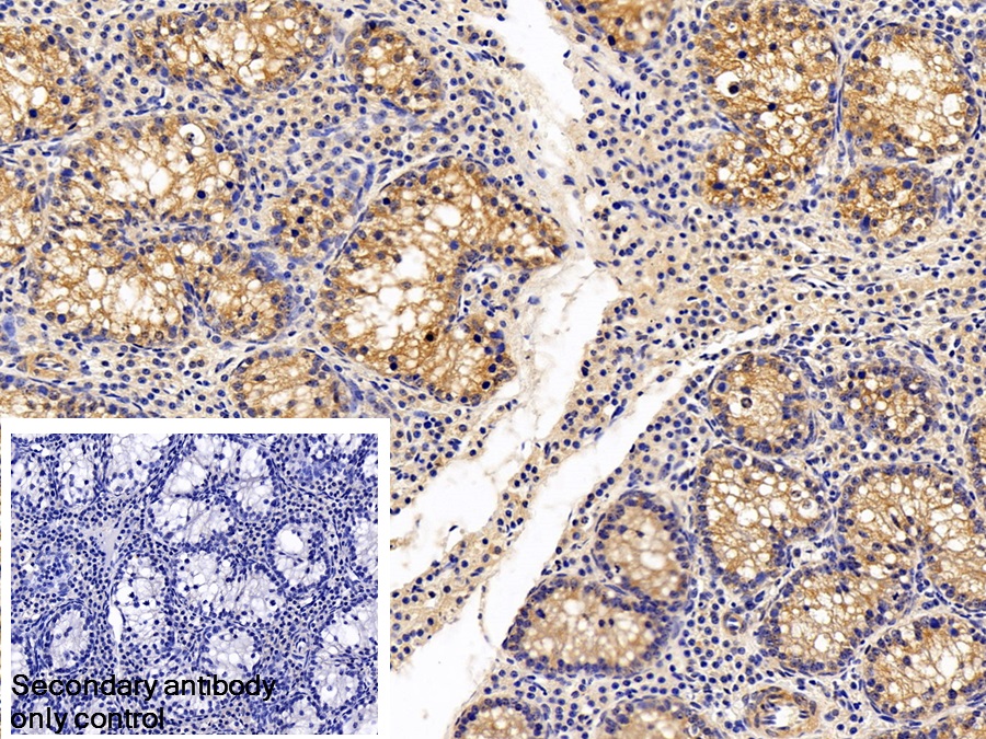 Polyclonal Antibody to Paraoxonase 1 (PON1)