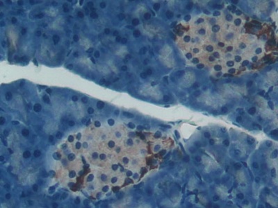 Polyclonal Antibody to Paraoxonase 1 (PON1)