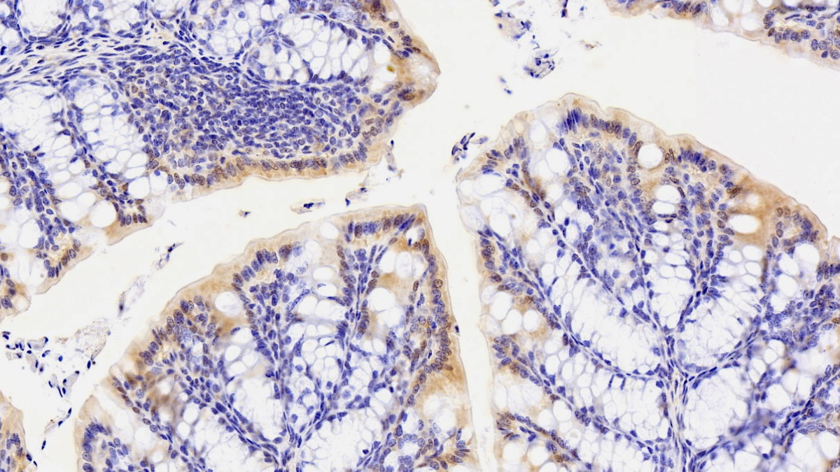 Polyclonal Antibody to Paraoxonase 1 (PON1)