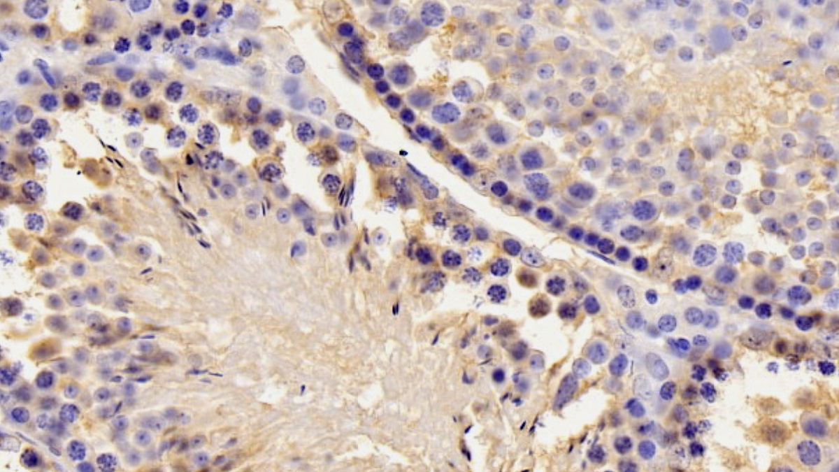 Polyclonal Antibody to Paraoxonase 1 (PON1)