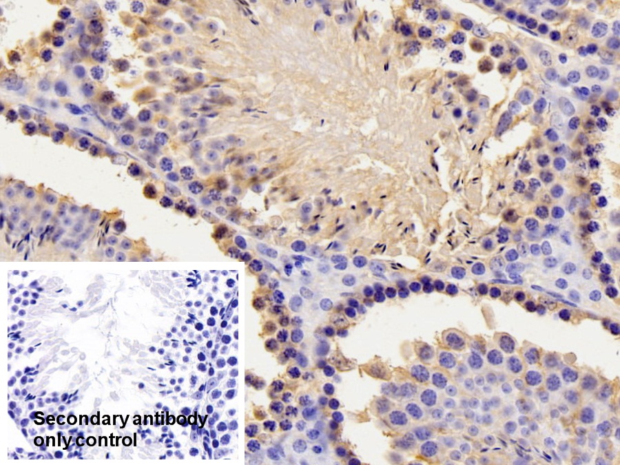 Polyclonal Antibody to Paraoxonase 1 (PON1)