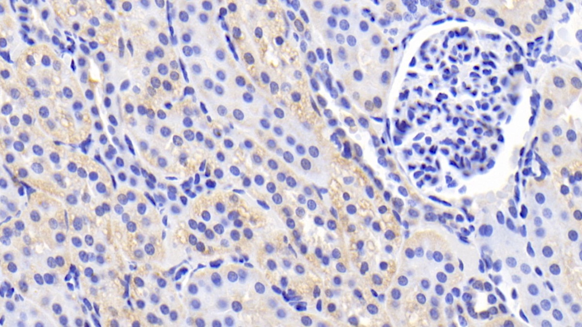 Polyclonal Antibody to Caspase 2 (CASP2)