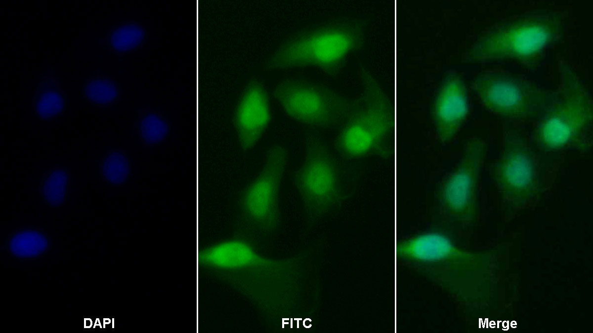 Polyclonal Antibody to Caspase 2 (CASP2)