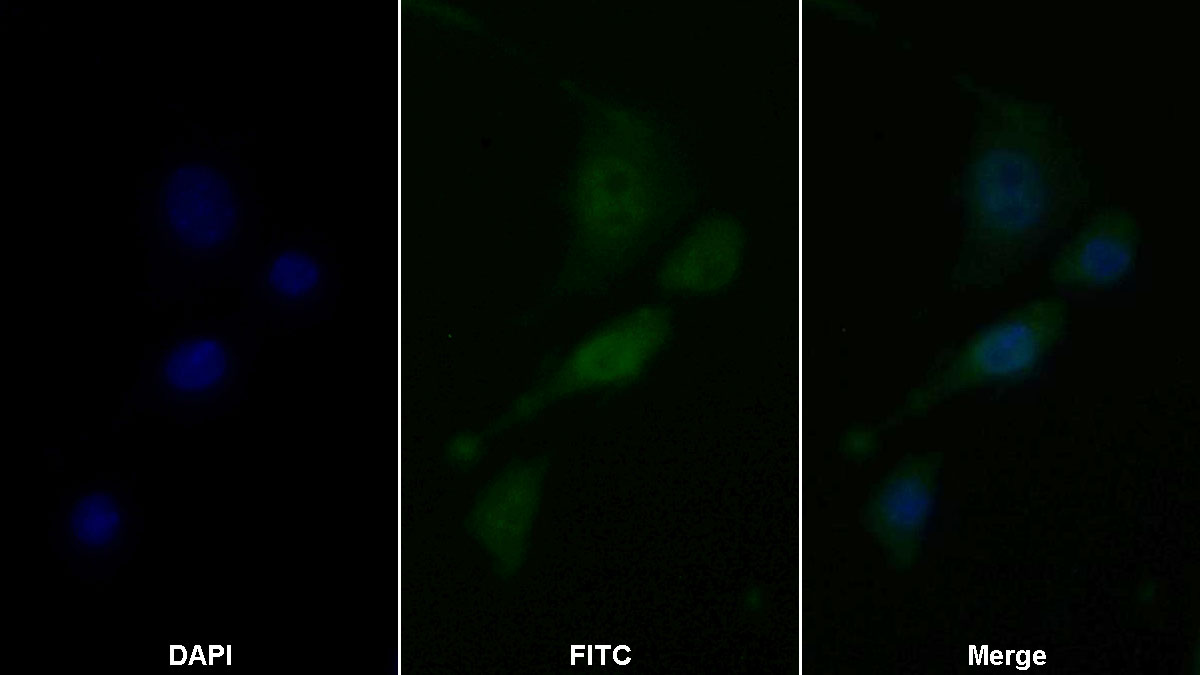 Polyclonal Antibody to Caspase 2 (CASP2)