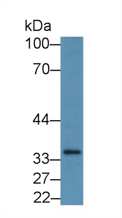 Polyclonal Antibody to Prostaglandin E Receptor 2 (EP2)