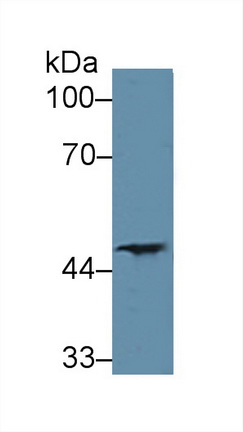 Polyclonal Antibody to Prostaglandin E Receptor 2 (EP2)