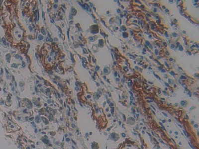 Polyclonal Antibody to Nischarin (NISCH)