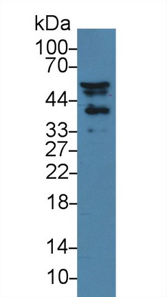 Polyclonal Antibody to Nischarin (NISCH)