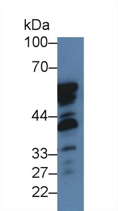 Polyclonal Antibody to Nischarin (NISCH)