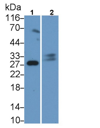 Polyclonal Antibody to Trypsin (TRY)