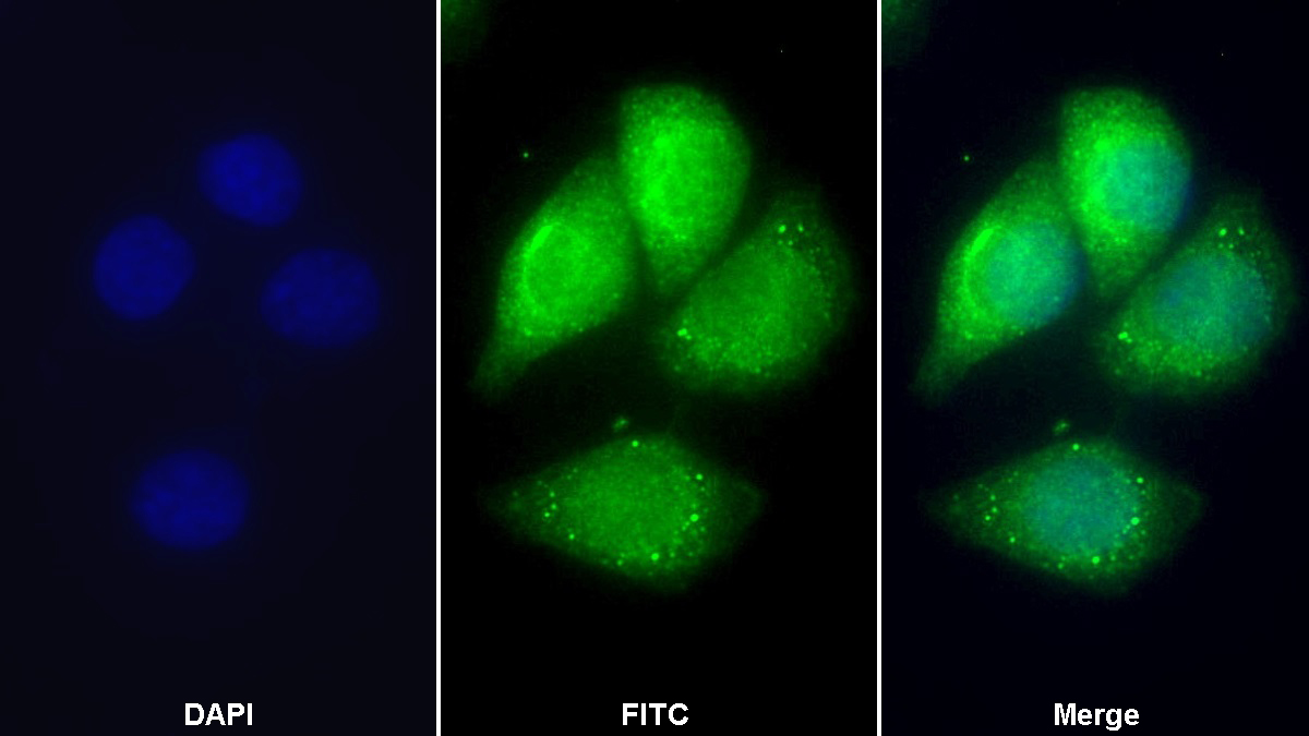 Polyclonal Antibody to Apolipoprotein C1 (APOC1)