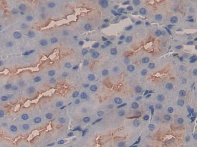 Polyclonal Antibody to Apolipoprotein C1 (APOC1)