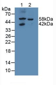 Polyclonal Antibody to N-Acetylgalactosamine-6-Sulfatase (GALNS)