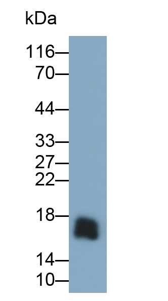 Polyclonal Antibody to Beta-2-Microglobulin (b2M)