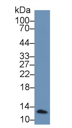 Polyclonal Antibody to Beta-2-Microglobulin (b2M)