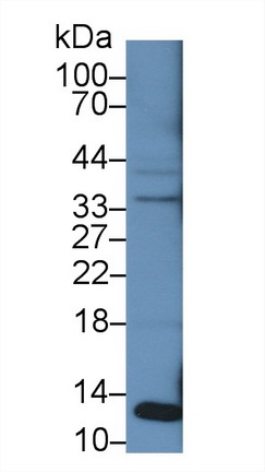 Polyclonal Antibody to Beta-2-Microglobulin (b2M)