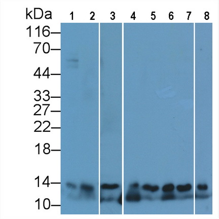 Polyclonal Antibody to Beta-2-Microglobulin (b2M)