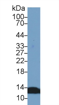 Polyclonal Antibody to Beta-2-Microglobulin (b2M)