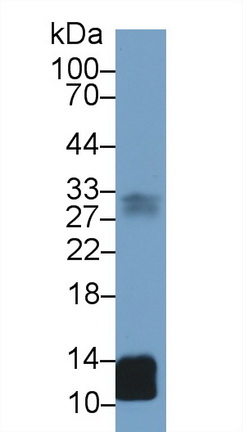 Polyclonal Antibody to Beta-2-Microglobulin (b2M)