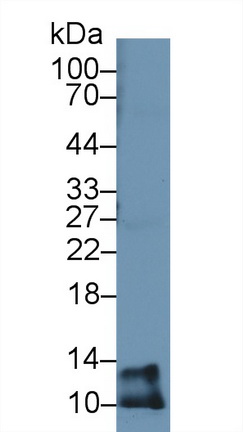 Polyclonal Antibody to Beta-2-Microglobulin (b2M)