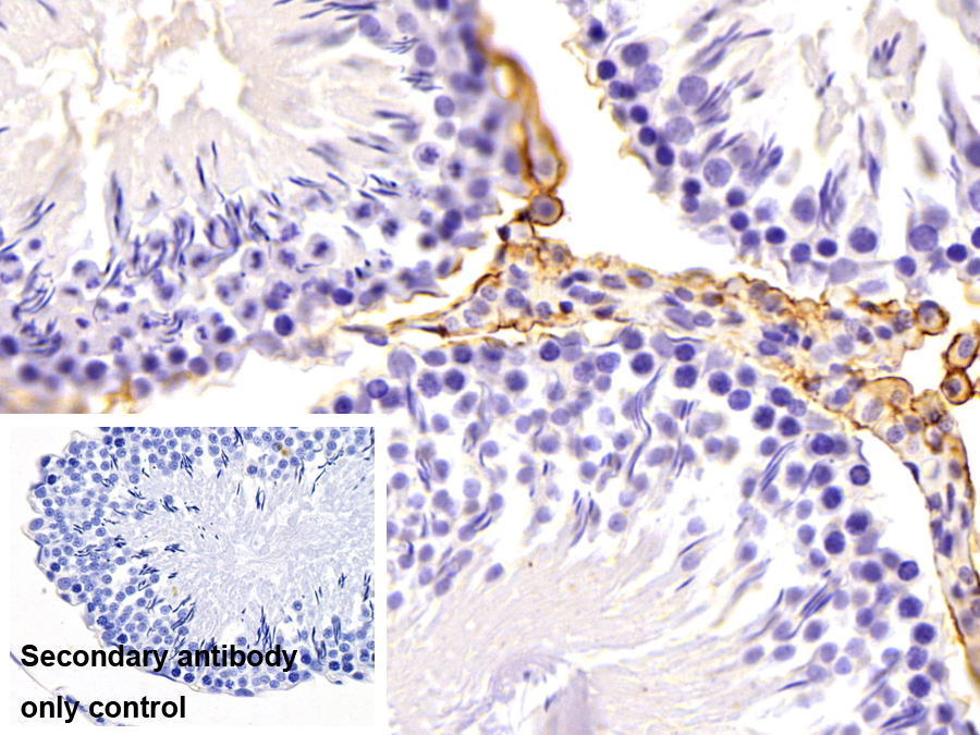 Polyclonal Antibody to Beta-2-Microglobulin (b2M)