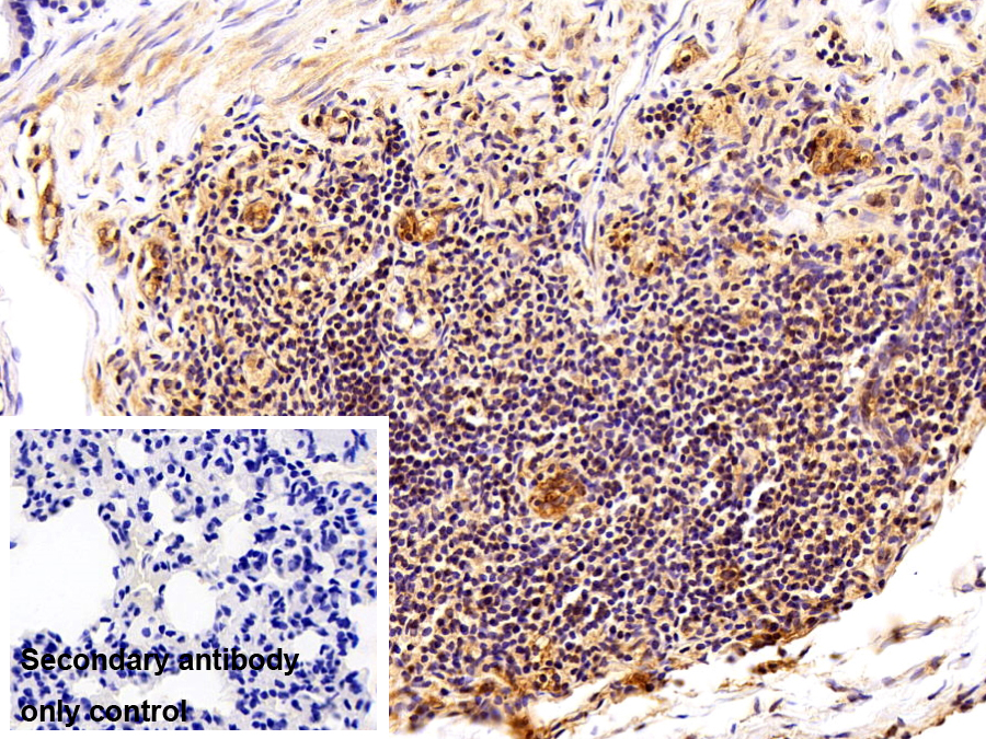 Polyclonal Antibody to Beta-2-Microglobulin (b2M)