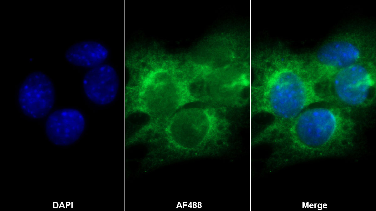 Polyclonal Antibody to Beta-2-Microglobulin (b2M)