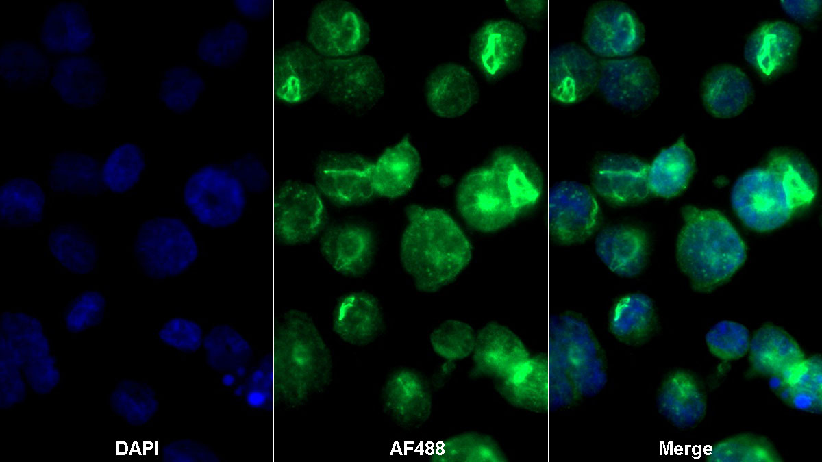 Polyclonal Antibody to Transferrin Receptor 2 (TFR2)