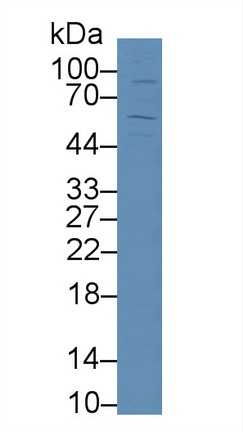 Polyclonal Antibody to Transferrin Receptor 2 (TFR2)