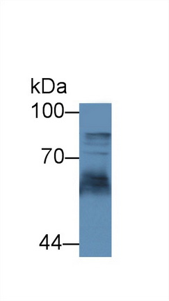 Polyclonal Antibody to Transferrin Receptor 2 (TFR2)