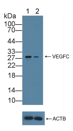 Polyclonal Antibody to Centromere Protein H (CENPH)