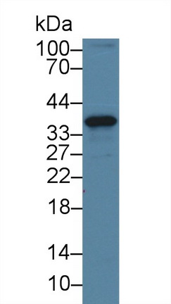 Polyclonal Antibody to Centromere Protein H (CENPH)