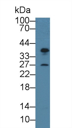 Polyclonal Antibody to Centromere Protein H (CENPH)