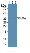 Polyclonal Antibody to Centromere Protein H (CENPH)